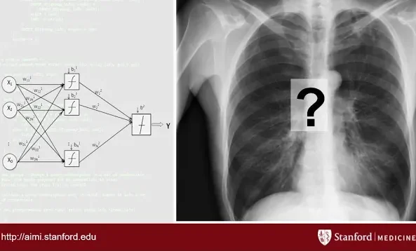 AI in Radiology at Stanford: Rise of the Machines